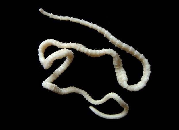Beef tapeworm in the human body