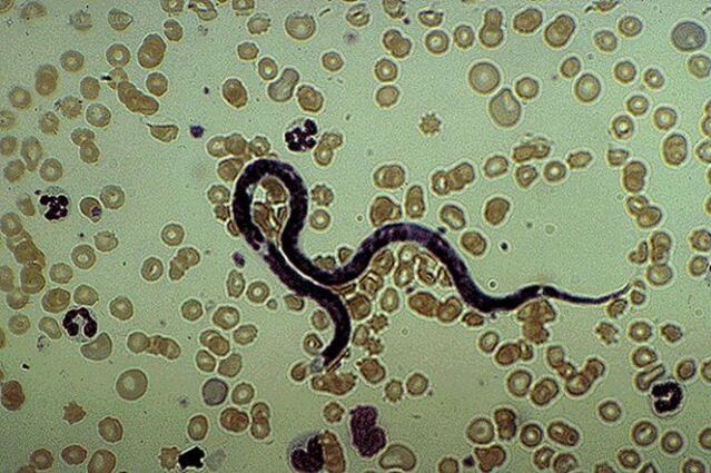 subcutaneous parasite Filaria