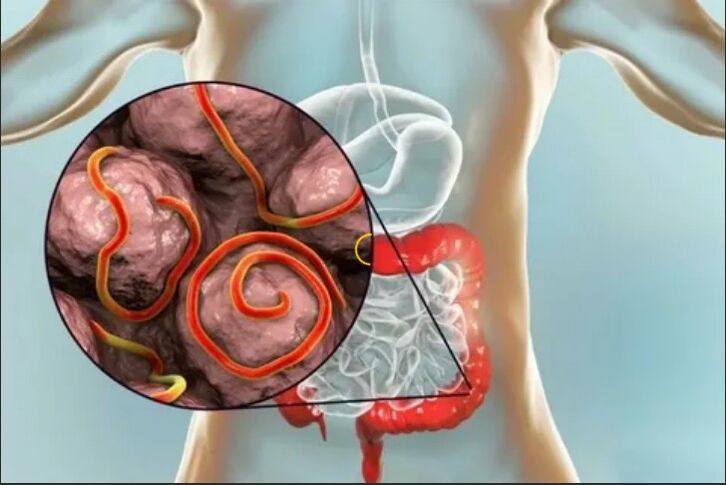 Parasites in the human organism