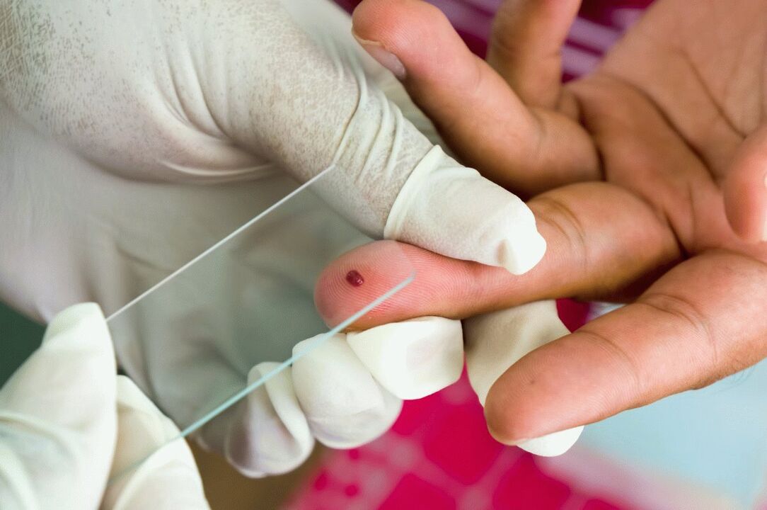 Blood test out of the finger