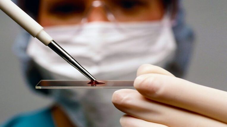 Blood sample