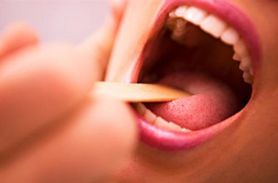 Types of parasites in the human mouth